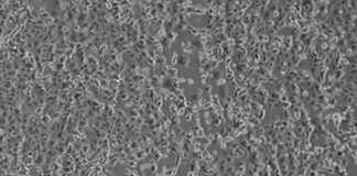 Coronavirus, positivo un italiano rimpatriato da Wuhan