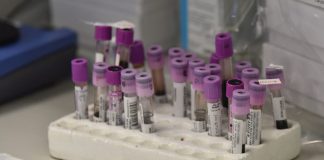 Coronavirus, c’e’ un’ipotesi sui “pazienti zero” in Veneto