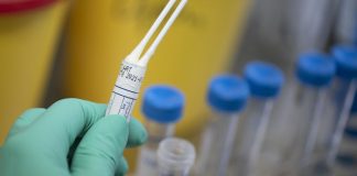 +6 i nuovi casi nel mantovano. Sale di 1 il capoluogo (305) e di 2 Castel Goffredo (127). In totale i casi sono 3.179 Gita in pullman in Campania: al ritorno 5 partecipanti positivi