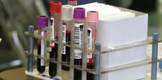 Covid, migliorano al Poma i 5 pazienti già trattati con plasma da guariti. Terapia a brevissimo per altri 20 Covid, migliorano al Poma i 5 pazienti già trattati con plasma da guariti. Terapia a brevissimo per altri 20