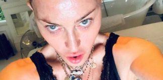Madonna “Mi sottoporro’ a un intervento di medicina rigenerativa”