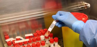 Covid, nel mantovano morto un contagiato su cinque. 651 i decessi, 1994 i guariti Nel mantovano morto un contagiato su cinque. 651 i decessi, 1994 i guariti