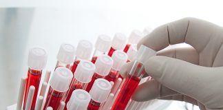 Covid, primo studio su potenziale cura con anticorpo. Ricavato dal sangue di uno dei primi guariti negli Usa Covid, primo studio su potenziale cura con anticorpo. Ricavato dal sangue di uno dei primi guariti negli Usa