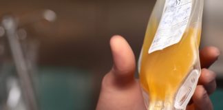 Plasma iperimmune, continuano le sperimentazioni e le donazioni negli ospedali lombardi per creare la banca del plasma Covid, al Poma per i malati servono 10 sacche di plasma al giorno. Mamme e persone trasfuse non possono donare