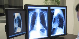 A Mantova 80 mila prestazioni sanitarie in arretrato. Si riparte con tempi più lunghi. Nuovi canali di prenotazione per i prelievi A Mantova 80 mila prestazioni sanitarie in arretrato. Si riparte con tempi più lunghi. Nuovi canali di prenotazione per i prelievi