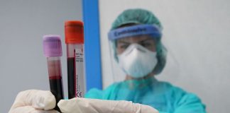 Coronavirus, 1.494 nuovi positivi e 16 decessi nelle ultime 24 ore