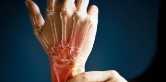 Artrite reumatoide, il farmaco Rinvoq adesso rimborsabile in Italia