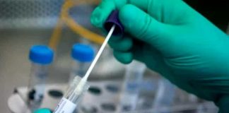 Covid, sintomi e criteri diagnostici: cosa cambia con la nuova circolare del Ministero A Mantova contagi da zona rossa già a inizio marzo: incidenza di 263 casi 100 mila abitanti