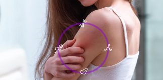 Farmaci, AbbVie: ‘Ok Chmp Ema per anti-dermatite atopica da moderata a grave’