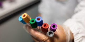 Covid Abruzzo, oggi 25 contagi e nessun decesso: bollettino 18 giugno