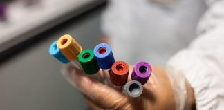 Focolaio covid palestra Milano, 14 contagi: 5 sono variante Delta