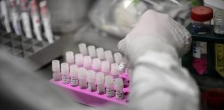 Variante Delta, “rischio più alto di ricoveri”