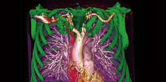 Al Gemelli Molise Tac innovativa per esami più rapidi e meno radiazioni