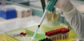 Covid, lo studio: alterazioni livello sodio ‘spia’ esito malattia