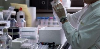 Nella dopamina la chiave per diagnosi precoce Alzheimer: lo studio