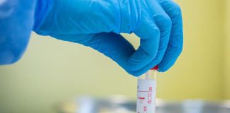 Covid oggi Piemonte, 36 contagi e 1 morto: bollettino 24 giugno