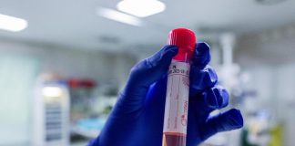 Covid oggi Sicilia, 158 contagi e 6 morti: bollettino 23 giugno