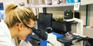 Parkinson, caffeina nella saliva ‘spia’ per monitorare evoluzione