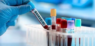 Punti prelievo chiusi nel periodo estivo, ecco le date