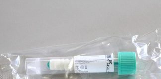 Covid, Abrignani: “Tamponi salivari non sostituiscono vaccinazione”