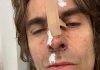 Liam Gallagher cade dall’elicottero e si ferisce