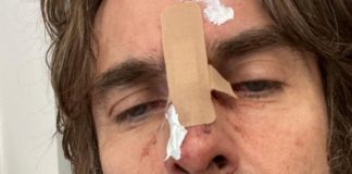 Liam Gallagher cade dall’elicottero e si ferisce