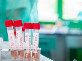 Prefettura e Ats: un solo caso segnalato nel comune capoluogo