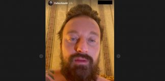 Francesco Facchinetti: “Conor McGregor mi ha picchiato”