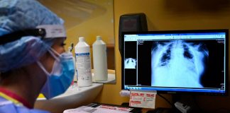 Covid oggi Italia, Ricciardi: “Non ne siamo ancora lontanamente usciti”