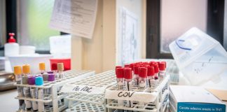 Esperti: “Test Ngs nuova arma diagnostica contro cancro polmone”