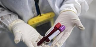 57 nuovi positivi nel mantovano secondo Prefettura e Ats. Mantova e Suzzara+6, Castiglione e Porto +5