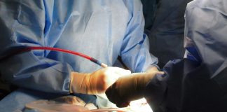 Occhio stampato in 3D impiantato in 47enne: è prima volta al mondo