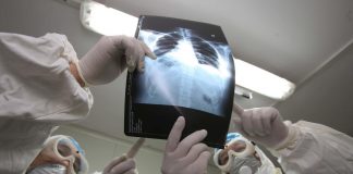 Artrite psoriasica malattia invalidante, diritti e esenzioni per pazienti
