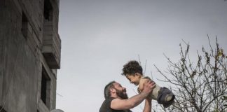 Dalla Turchia a Siena grazie a una foto, Munzir e Mustafa presto in Italia per l’intervento di protesi