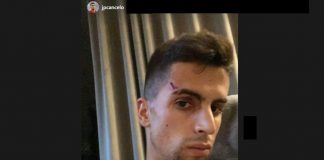Cancelo rapinato e ferito in casa