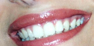 Cinque consigli per un sorriso sano nelle feste di Natale
