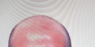 Sparito dopo essere partito per un’escursione. Drammatico appello per un uomo di Goito