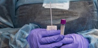 In Lombardia 50.104 i nuovi contagi (Mn +1654)