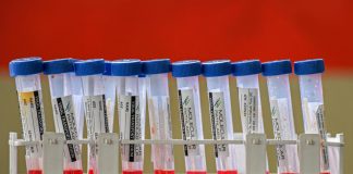 Covid, sono 1.646 i nuovi casi nel mantovano. Nel comune capoluogo +171 rispetto a ieri