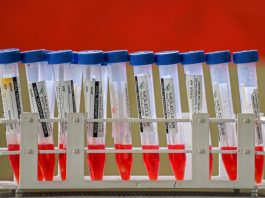 Covid, oggi 1.620 nuovi contagi. Mantova +185, Castiglione +156, Viadana +74, Suzzara +65