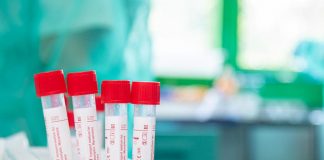 Variante Omicron domina in Italia, “all’81% il 3 gennaio”