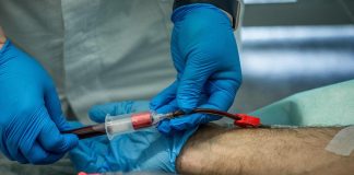 Malattie rare, Aieop: “Anemia falciforme invalidante e poco diagnosticata”