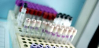 Covid oggi Calabria, 1.613 contagi e 6 morti: bollettino 28 febbraio