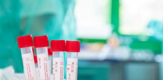 Covid, 192 nuovi positivi in provincia. Nel capoluogo + 25, a Porto Mantovano +20