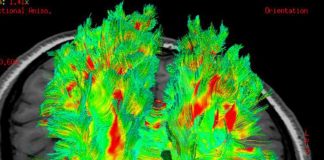 Cervello, così può ammalarsi per stress: studio apre a nuove cure