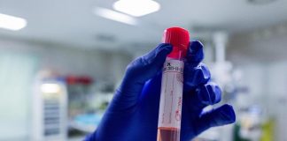 Covid nel mantovano: sono 111 i nuovi positivi. Mantova +15, Suzzara +13