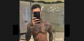 Fedez, foto su Instagram dopo operazione per tumore: “Ho perso quasi 10 kg”
