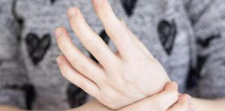 Reumatologo Possemato: “Dolore articolare spia per pazienti con psoriasi”