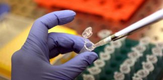 I pazienti: “Con nuova terapia beta-talassemia più tempo per noi”