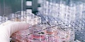 Vaiolo delle scimmie e vaccino: cosa dicono Bassetti, Galli e Gismondo